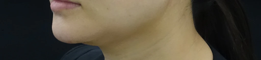 before_image