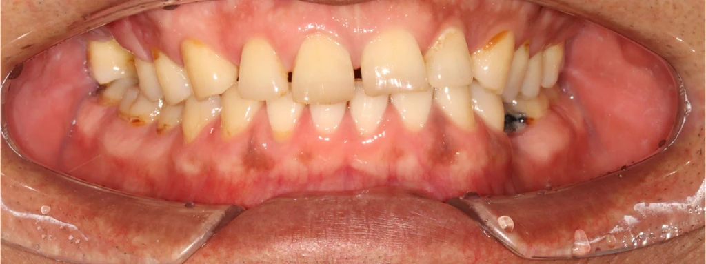 before_image