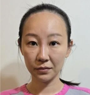 before_image