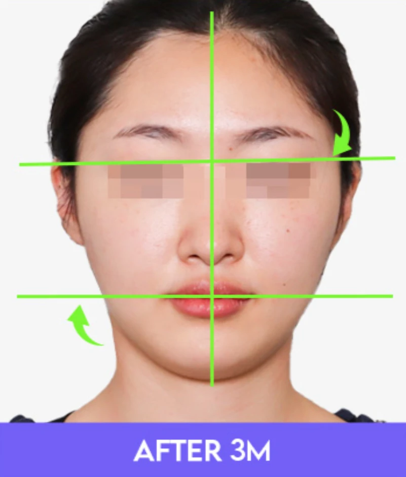 before_image