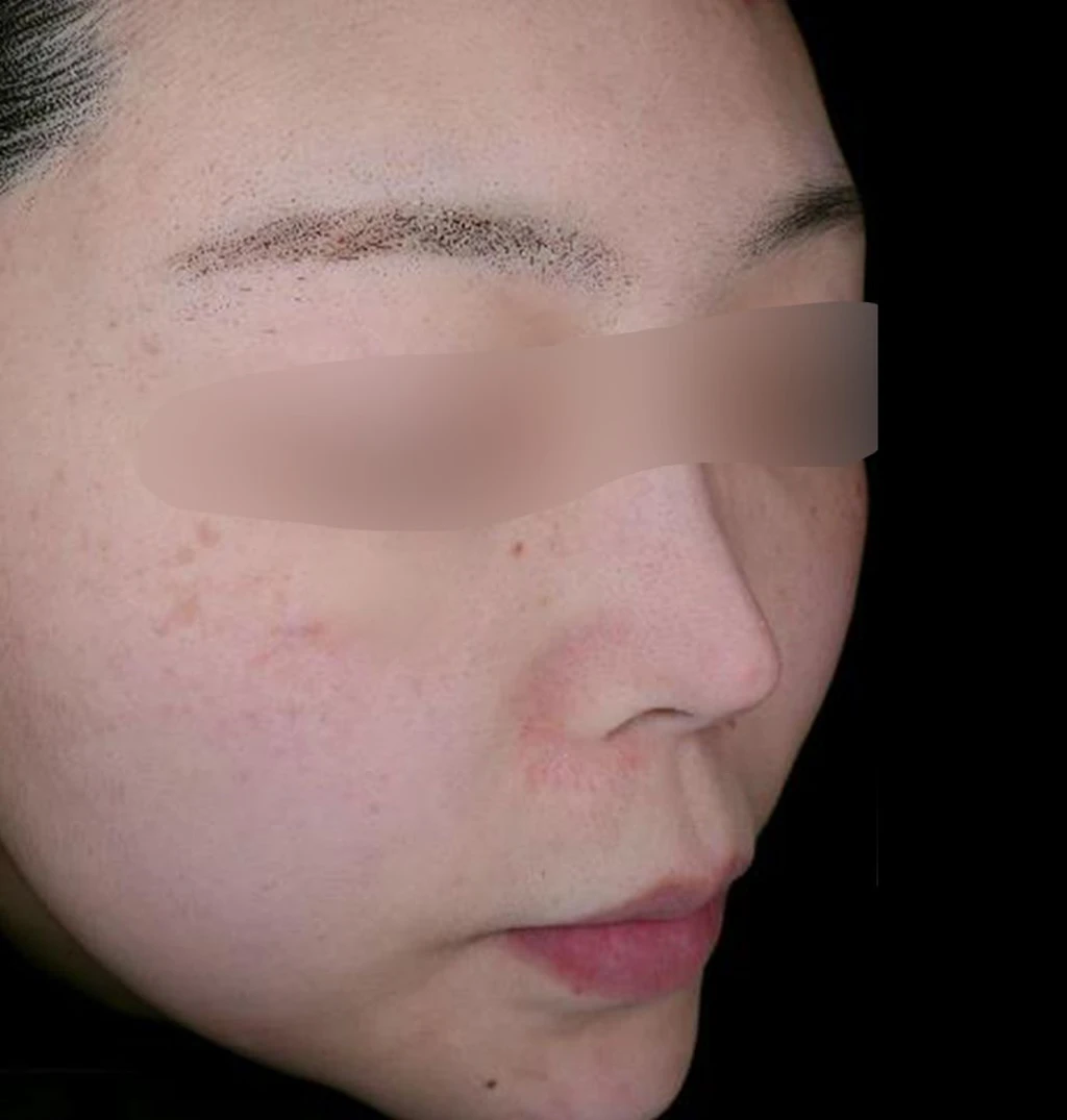 before_image
