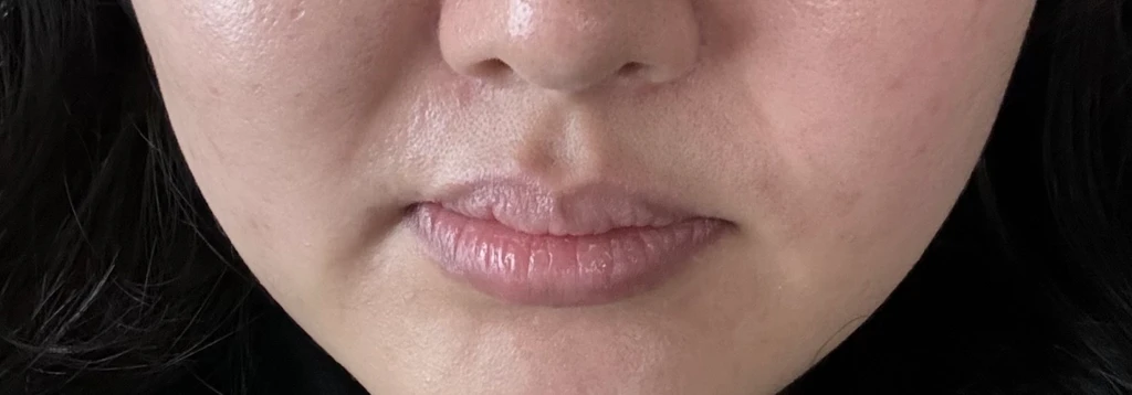 before_image