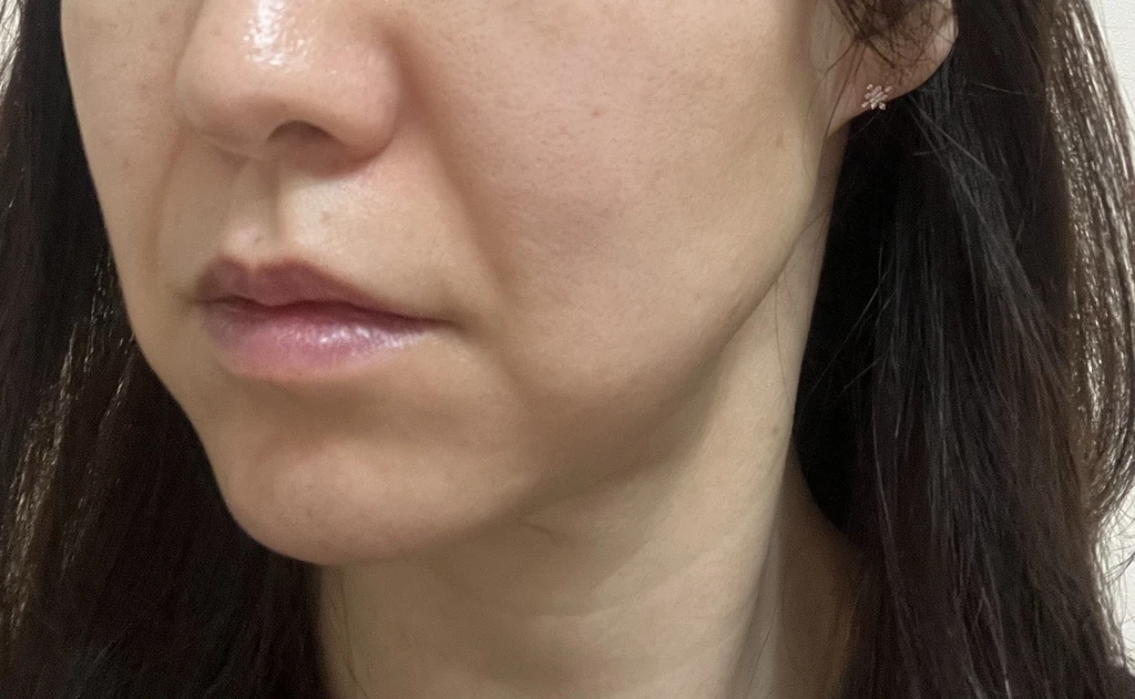 before_image