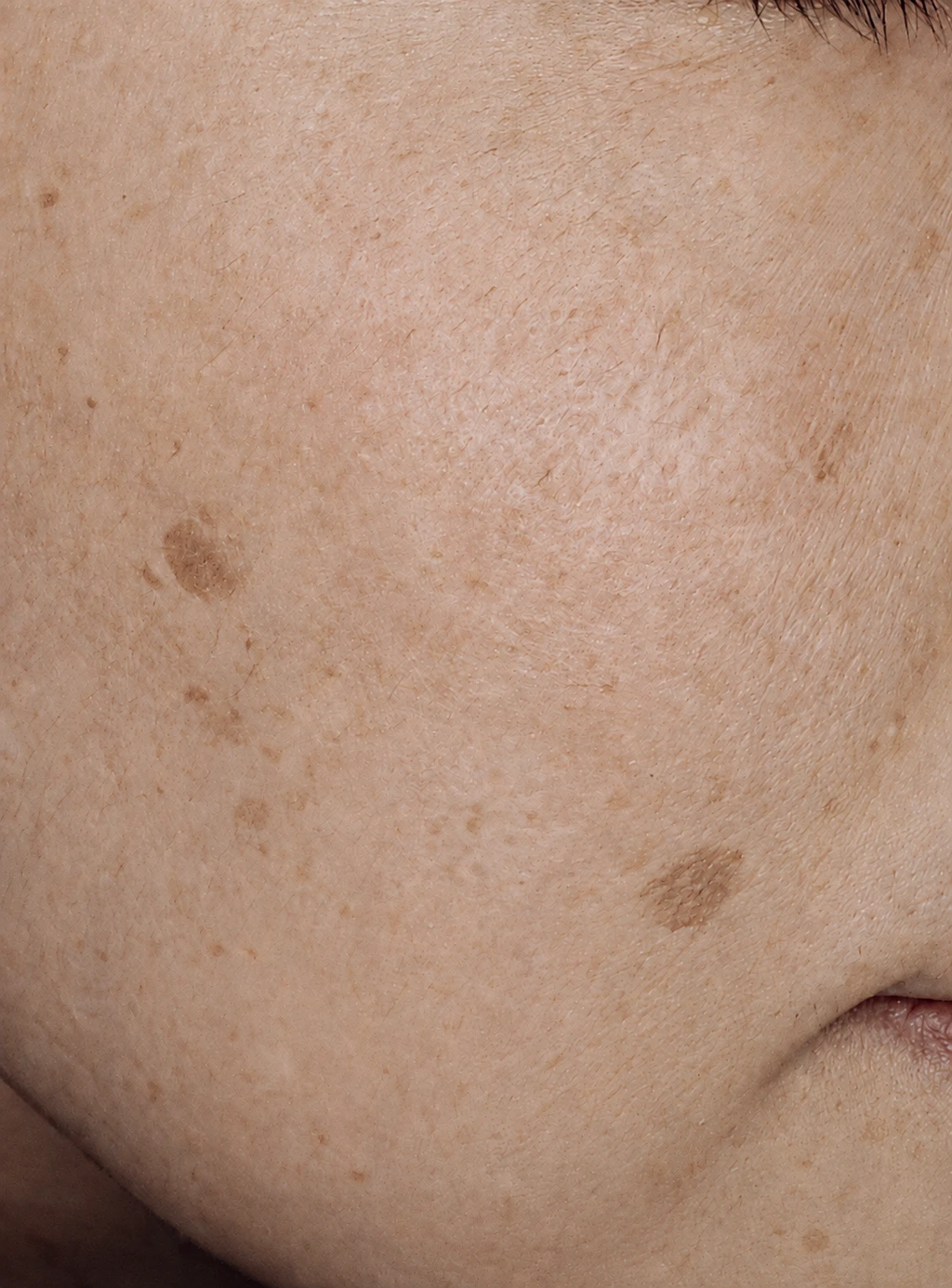 before_image