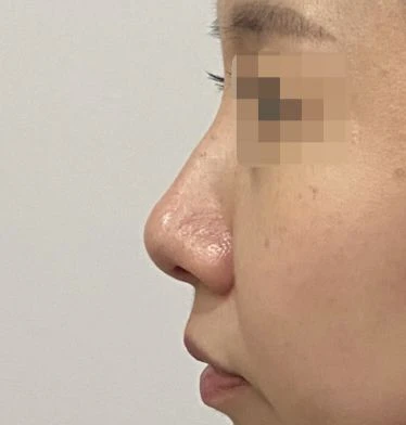 before_image