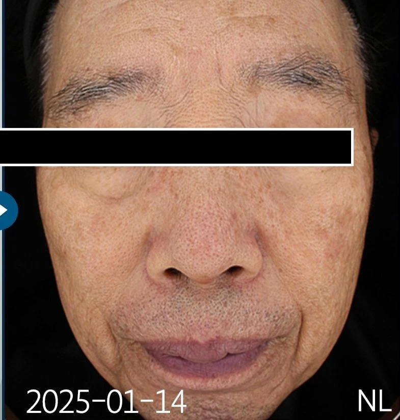 before_image
