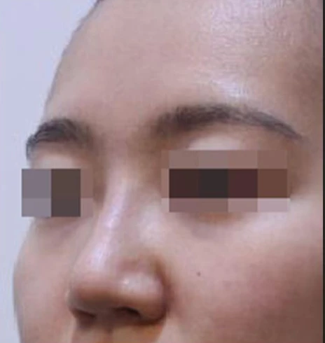 before_image