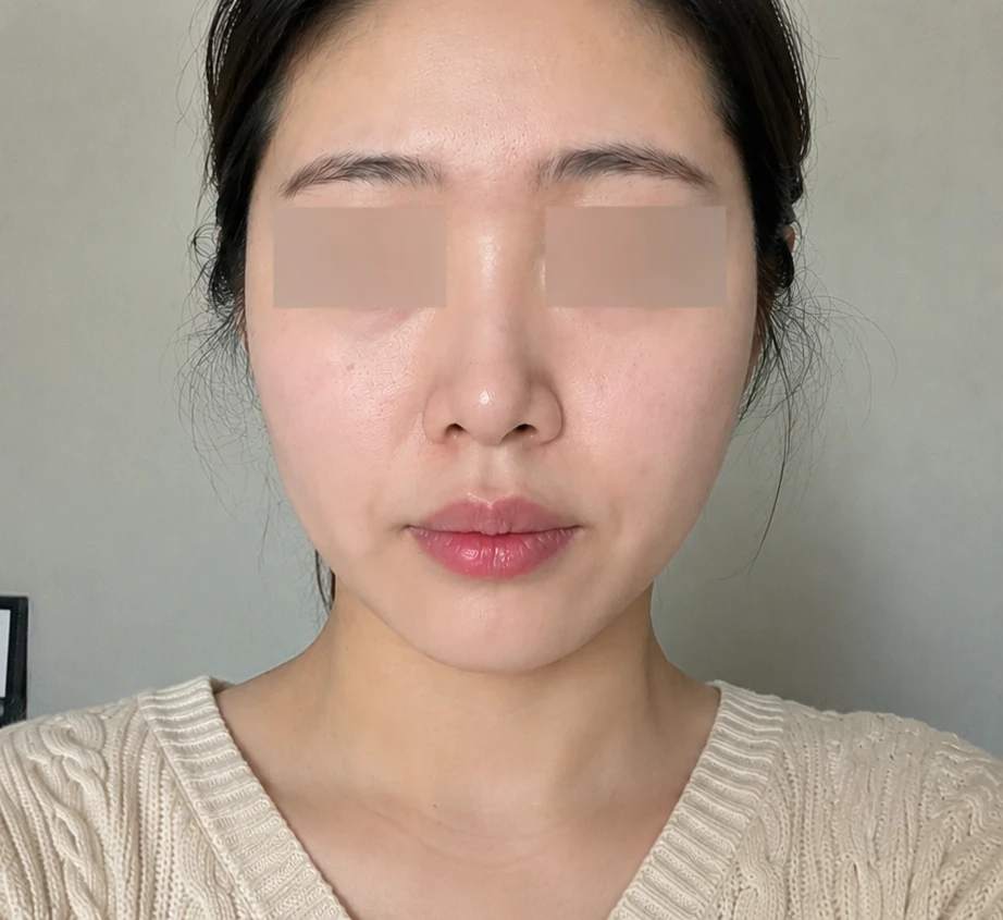before_image