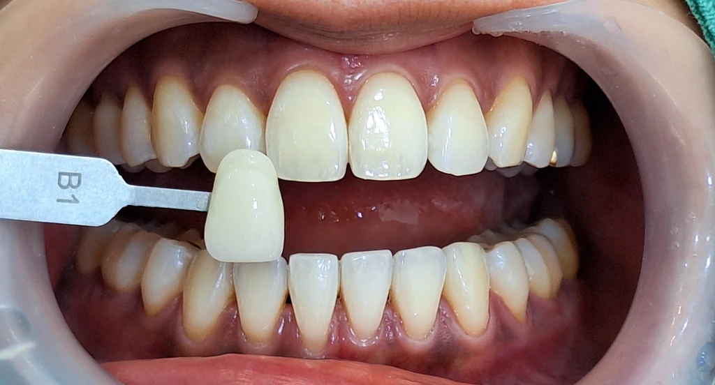 before_image