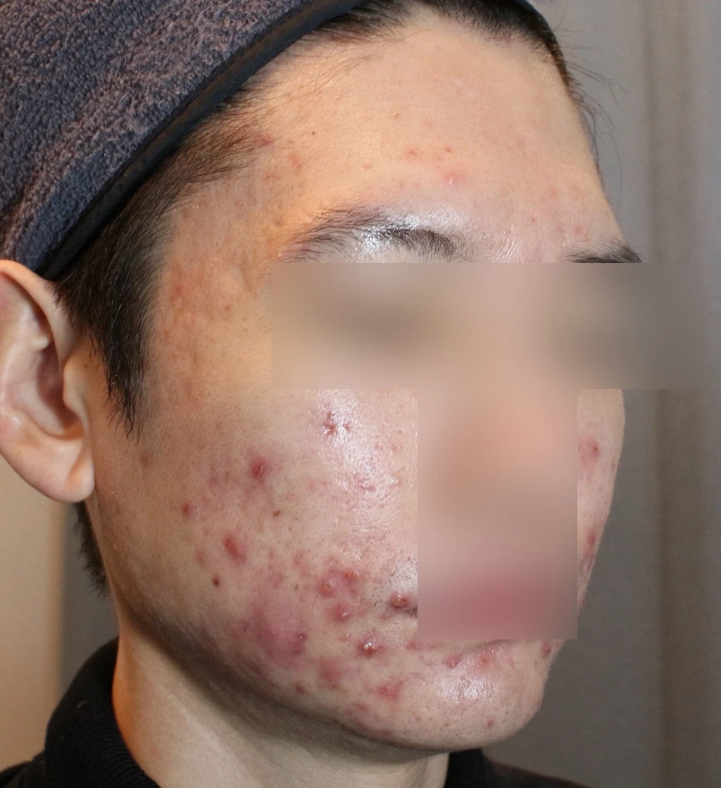 before_image