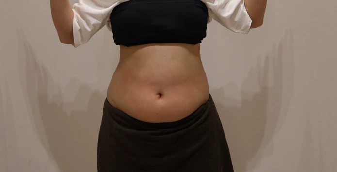 before_image
