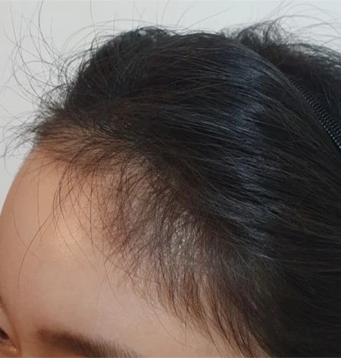 before_image