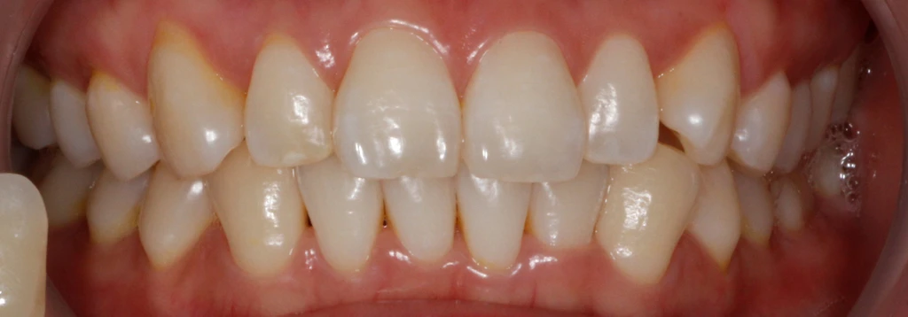 before_image