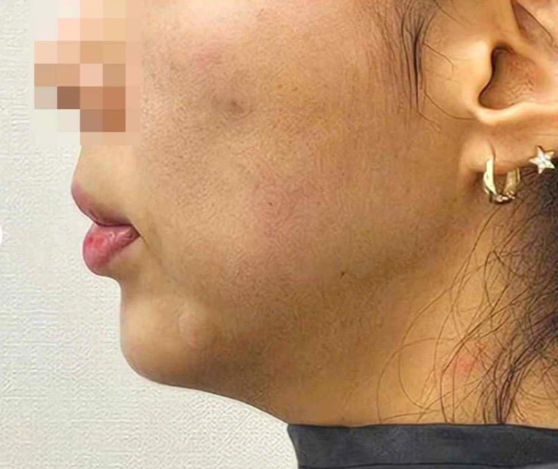before_image