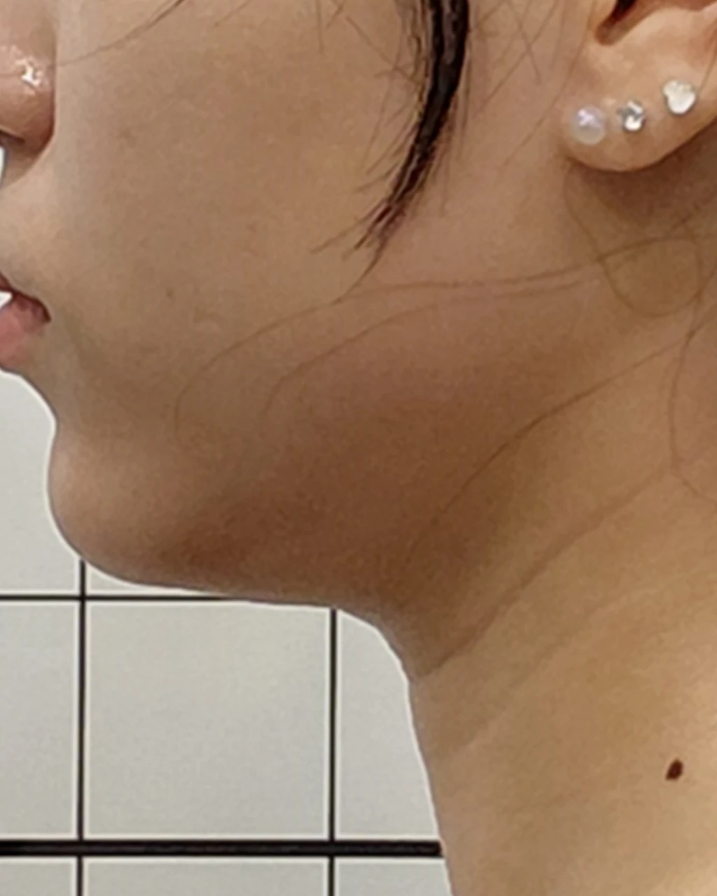 before_image