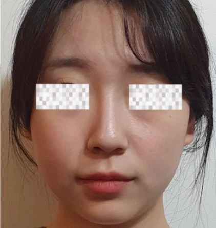 before_image