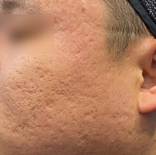 before_image