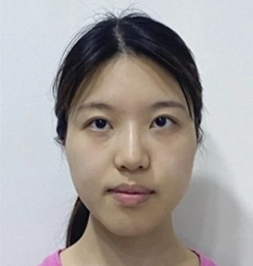 before_image