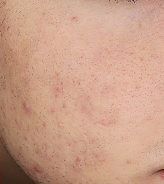 before_image