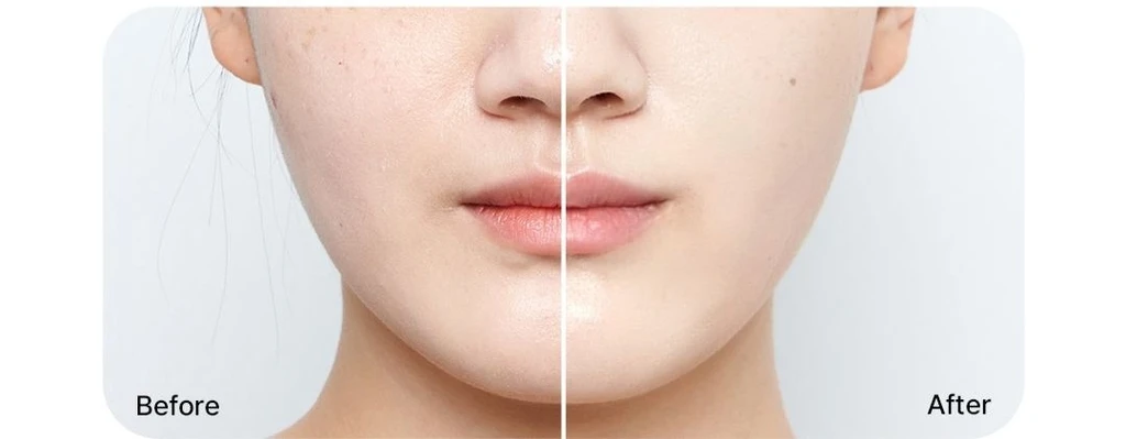 treatmentIntroduction
