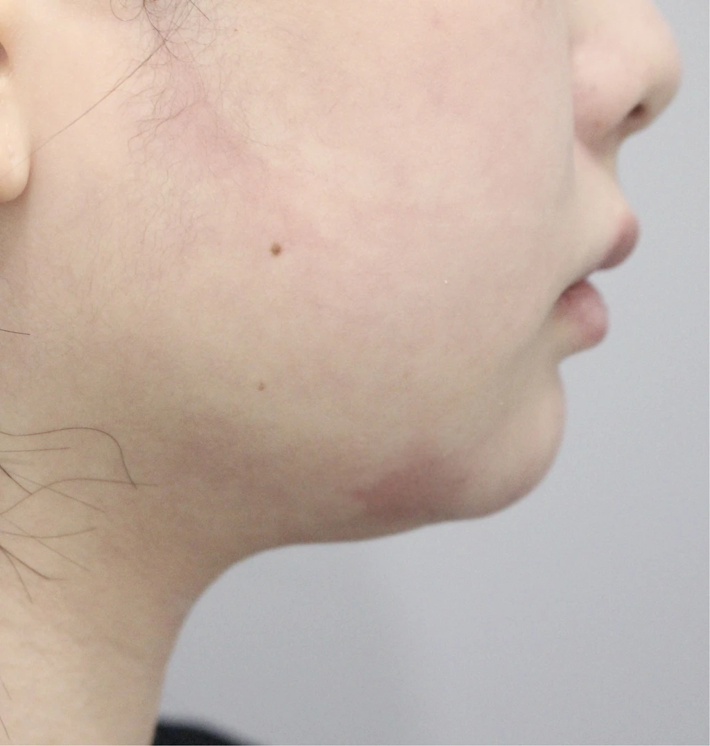 before_image