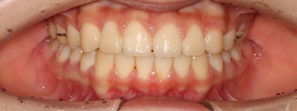 before_image