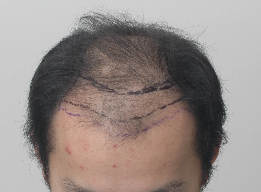 before_image