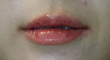 before_image