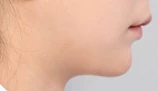 before_image