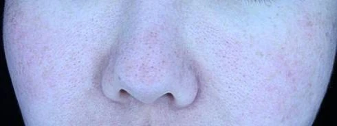 before_image