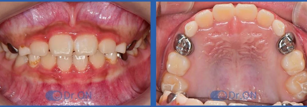 before_image
