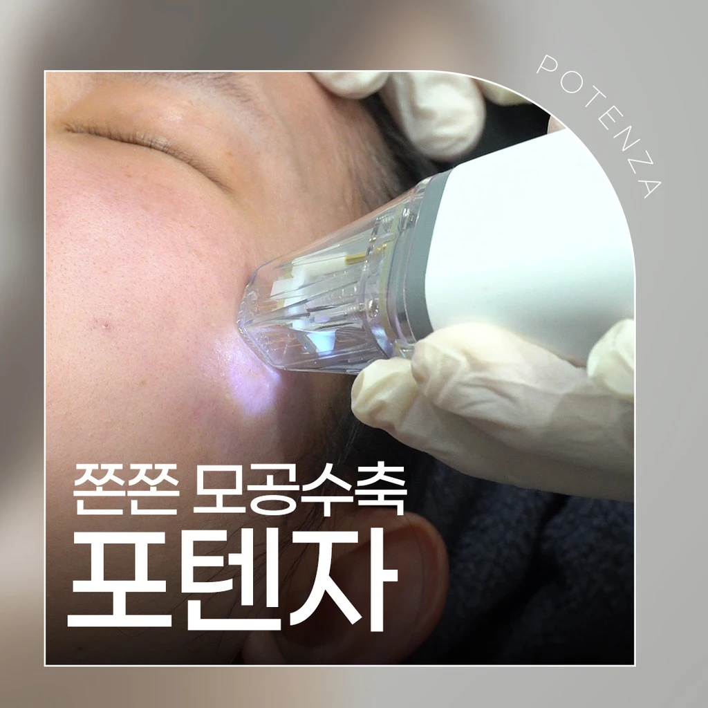 treatment-event-thumbnail