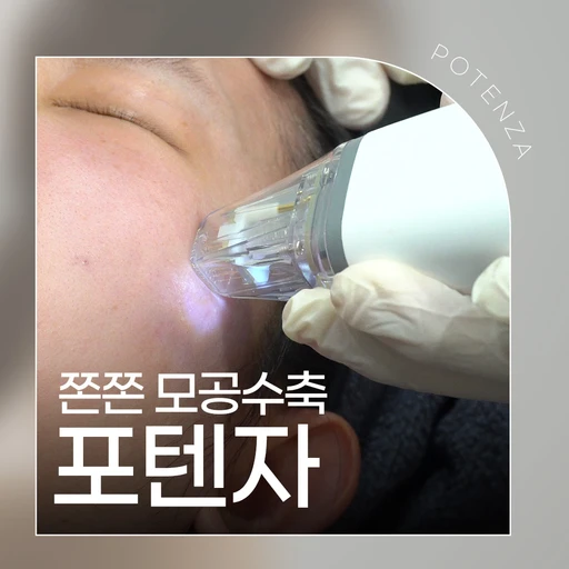 treatment-event-thumbnail