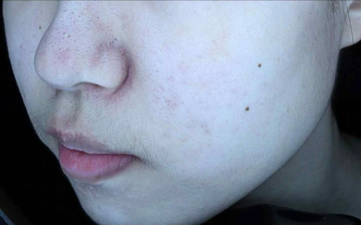 before_image