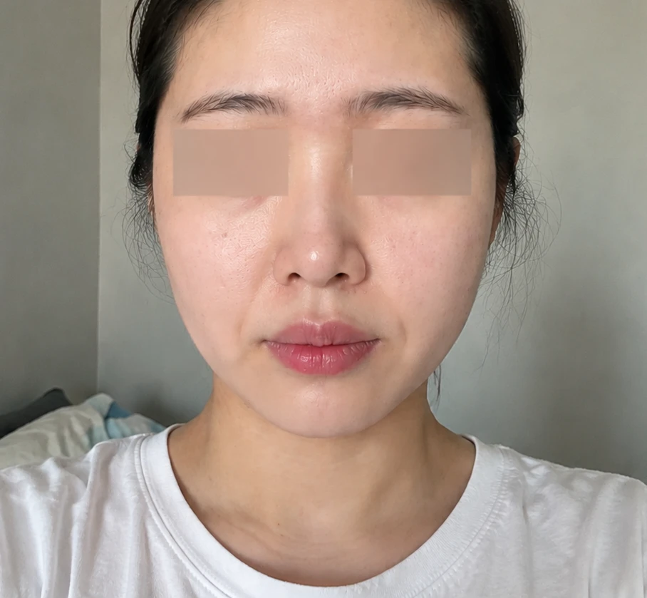 before_image