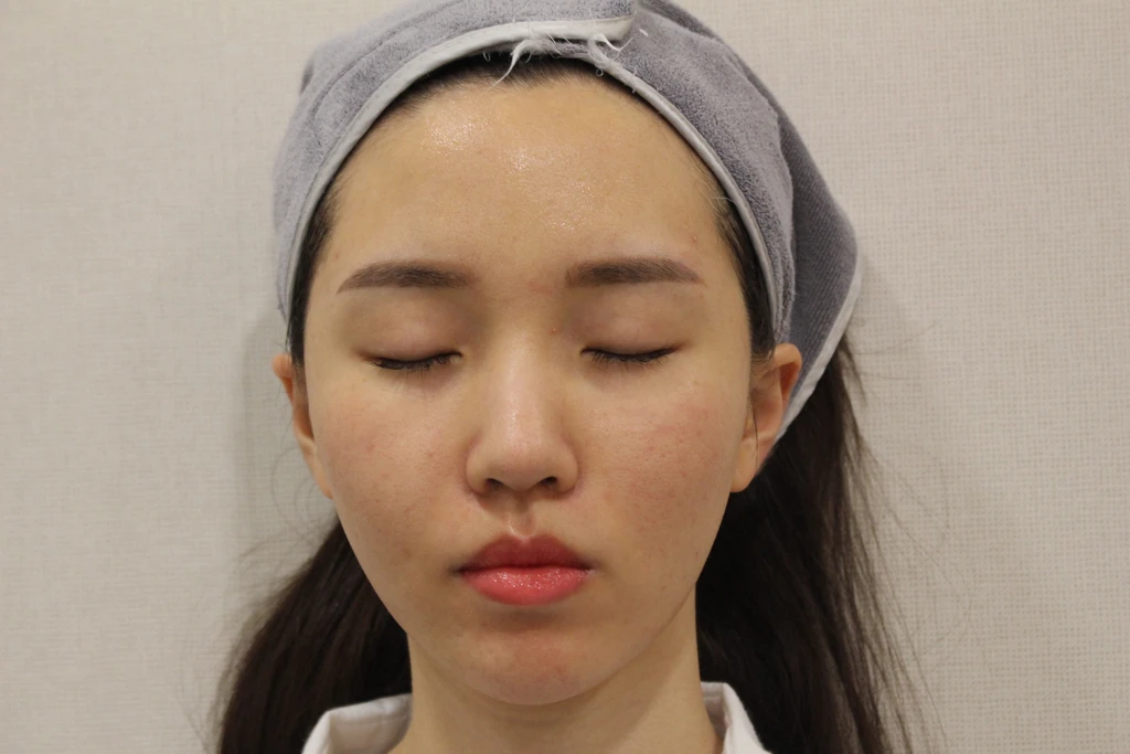 before_image