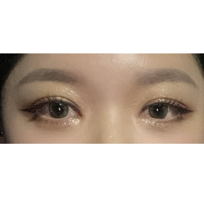 before_image
