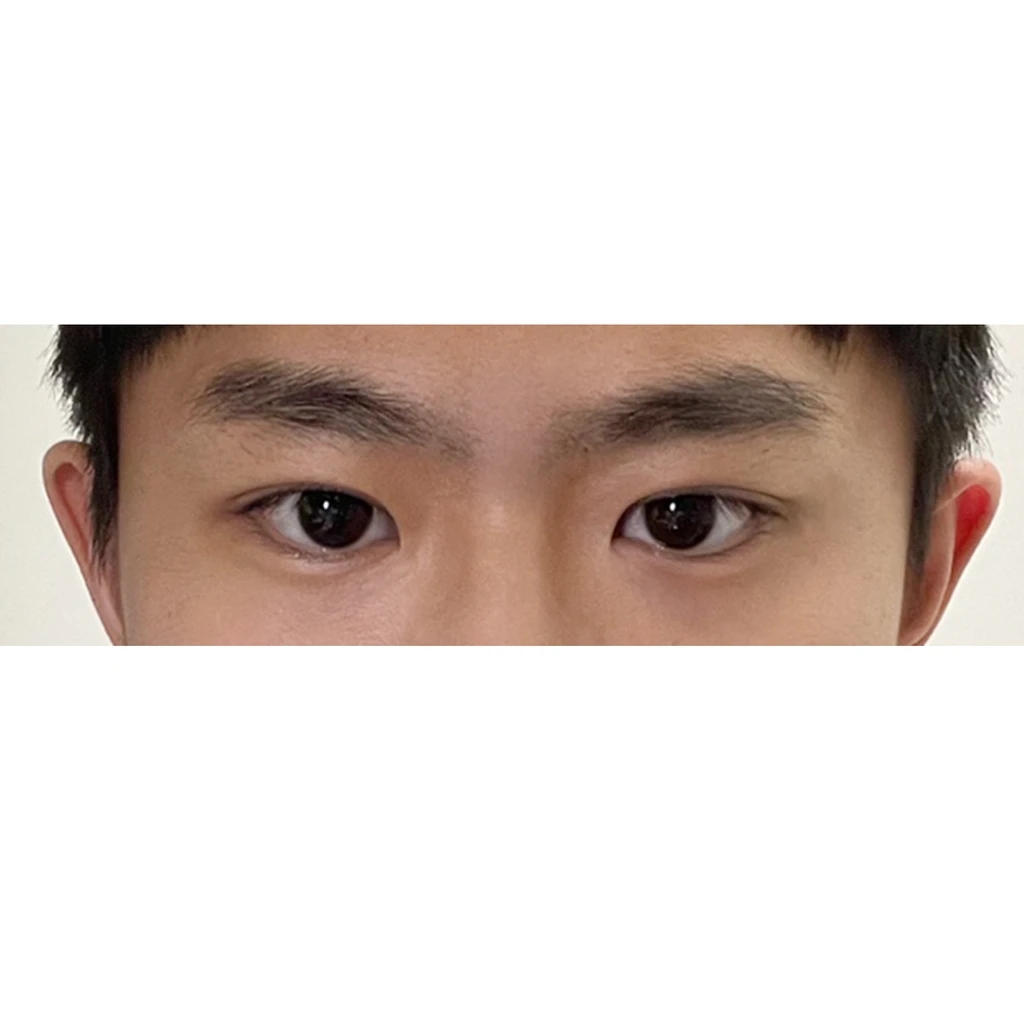 before_image