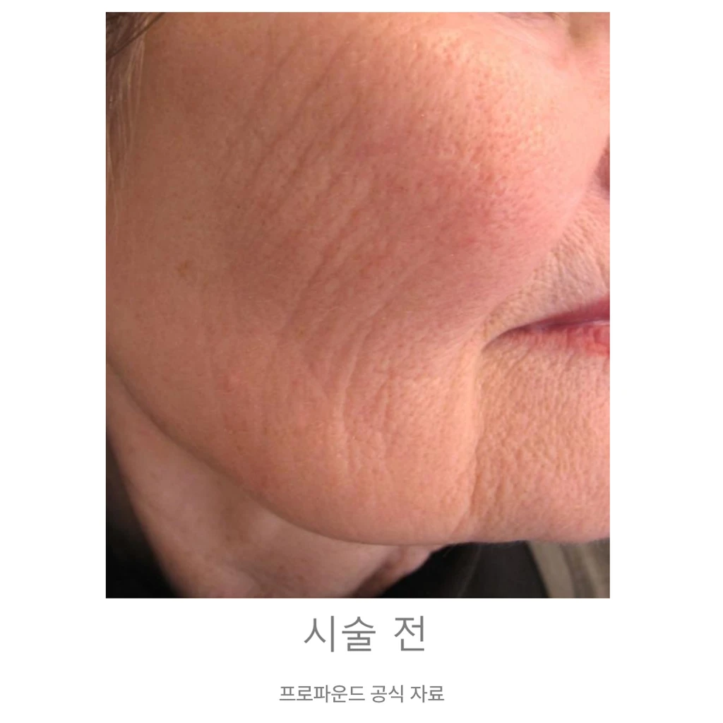 before_image