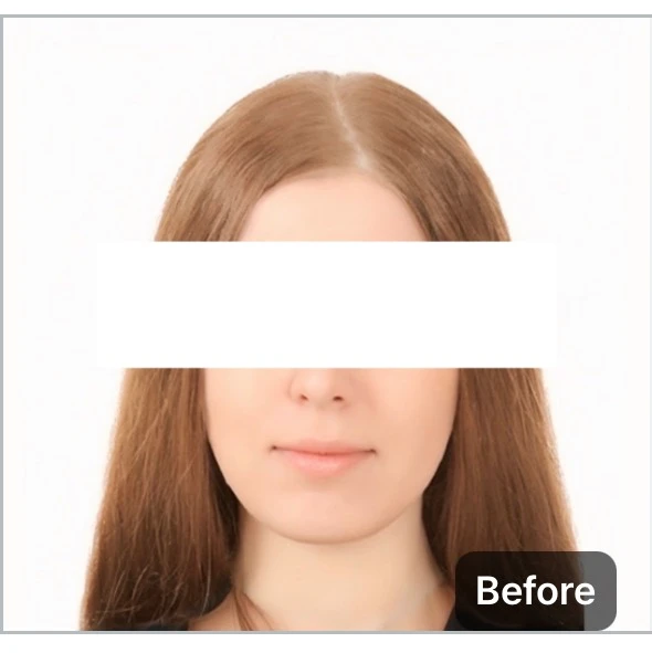 before_image