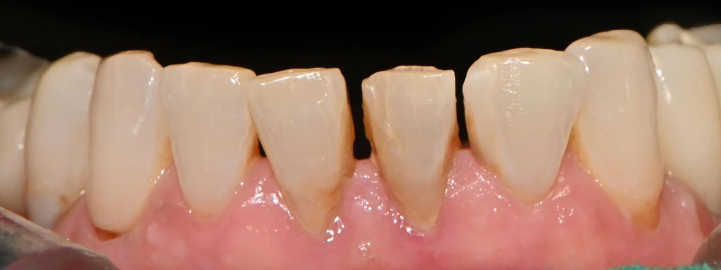 before_image