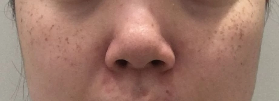 before_image