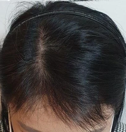 before_image