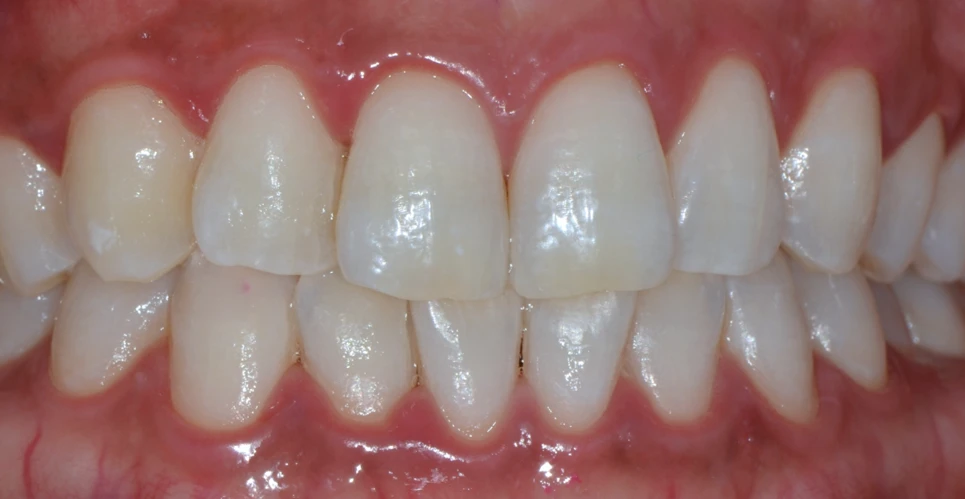 before_image