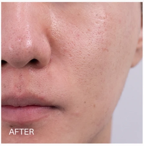 before_image