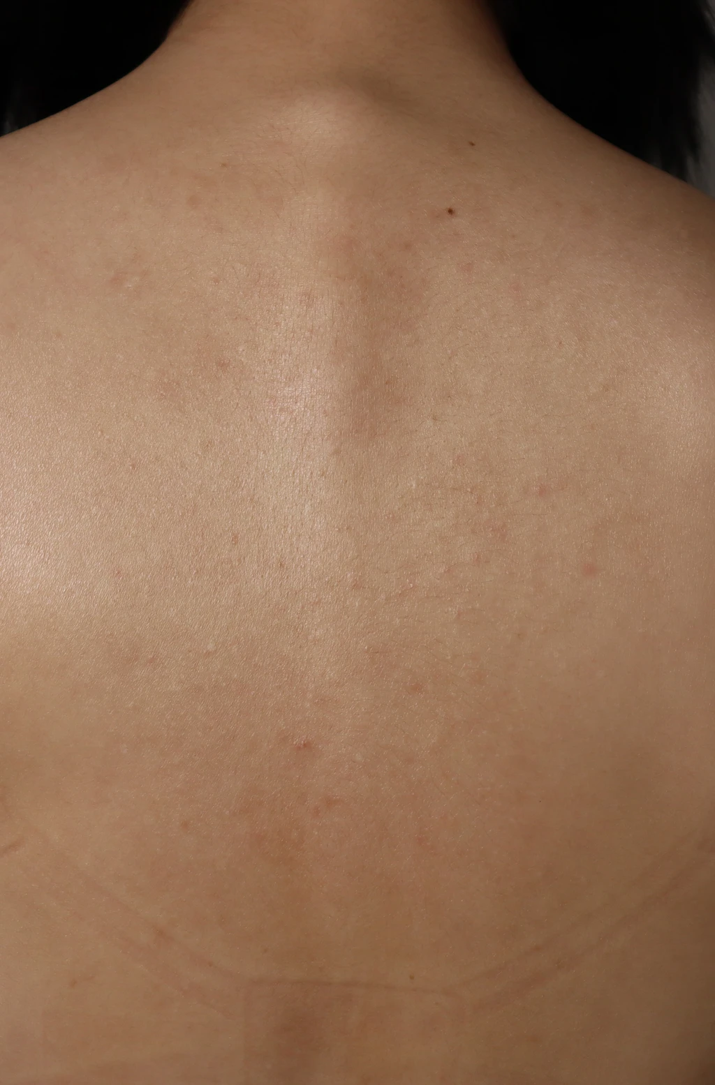 before_image