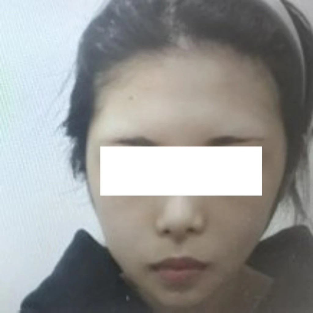 before_image