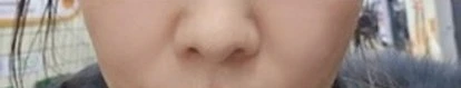 before_image