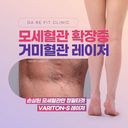 treatment-event-thumbnail