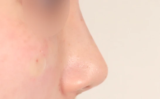 before_image